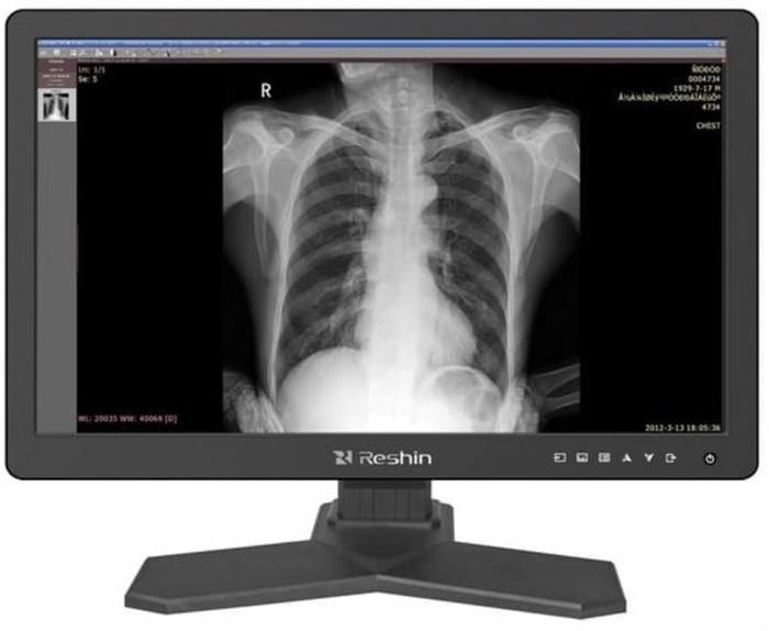 Монитор;24";RESHIN;MD26C 126862