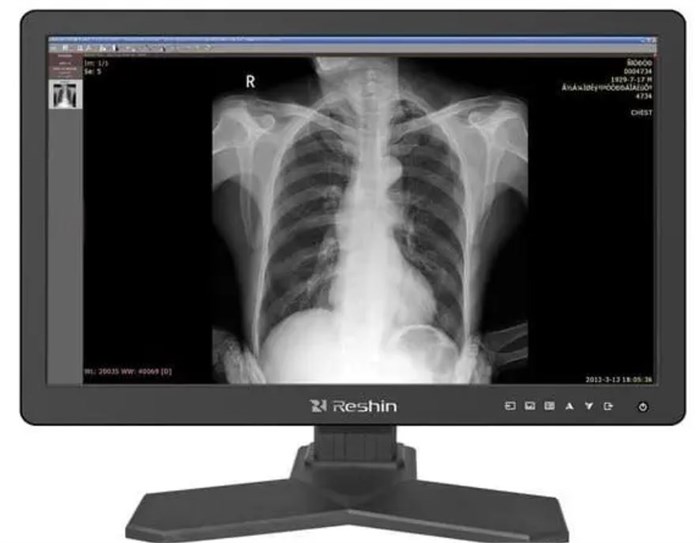 Монитор;21,3";RESHIN;MD26GA 124807