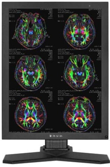 Монитор;21,3";RESHIN;MD32C 124808